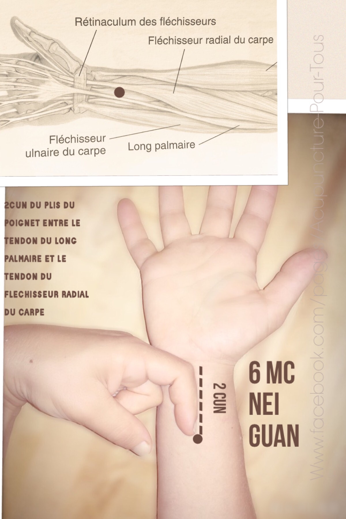 Les Points D Acupression Calmer La Douleur Avec L Acupression SDYEM Les Points D Acupression Calmer La Douleur Avec L Acupression SDYEM