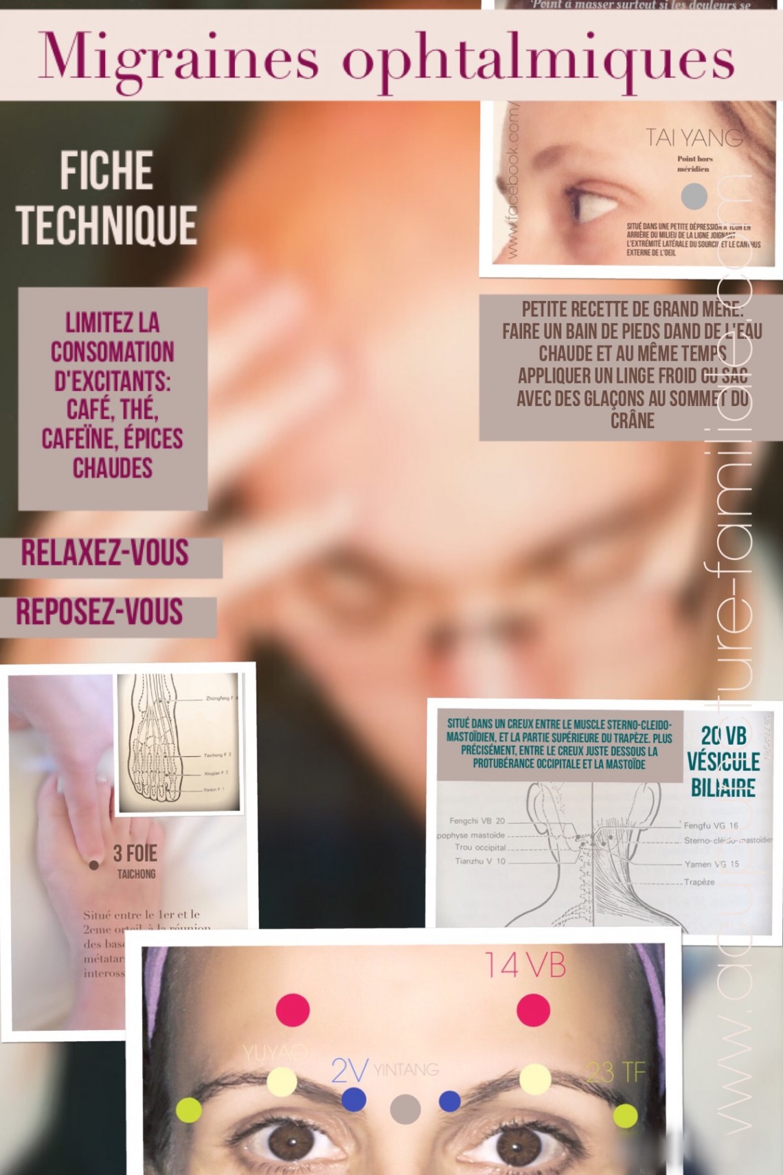 ACUPUNCTURE ET MIGRAINE OPHTALMIQUE Acupuncture Familiale